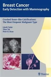 Book cover of Breast Cancer: Early Detection with Mammography by Laszlo Tabar