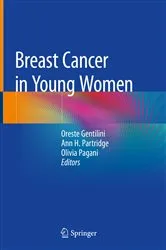 Book cover of Breast Cancer in Young Women by Unknown