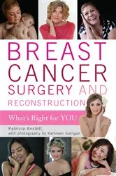 Book cover of Breast Cancer Surgery and Reconstruction by Unknown