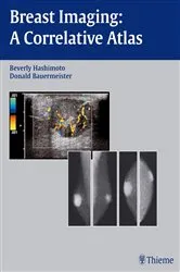 Book cover of Breast Imaging by Andrew D.A. Maidment
