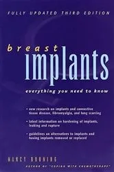 Book cover of Breast Implants by Nancy Bruning