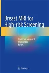 Book cover of Breast MRI for High-risk Screening by Francesco Sardanelli