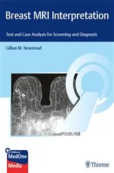 Book cover of Breast MRI Interpretation by Gillian M. Newstead