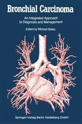 Book cover of Bronchial Carcinoma by Michael Bates