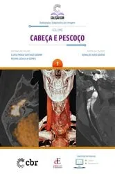 Book cover of Cabeça e Pescoço - Volume 1 by Ronaldo Hueb Baroni