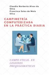 Book cover of Campimetría Computerizada en la Práctica Diaria by Claudio Norberto