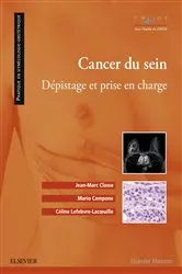 Book cover of Cancer du sein by Jean-Marc Classe