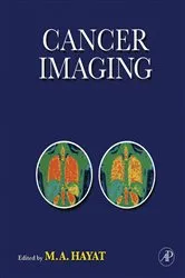 Book cover of Cancer Imaging by M. A. Hayat