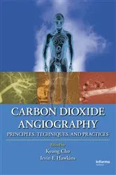 Book cover of Carbon Dioxide Angiography by Kyung Cho