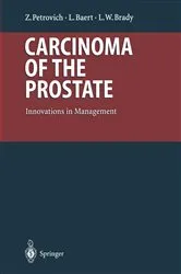 Book cover of Carcinoma of the Prostate by Zbigniew Petrovich