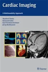 Book cover of Cardiac Imaging by Manfred Thelen
