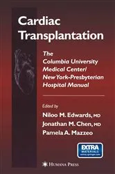 Book cover of Cardiac Transplantation by Niloo M. Edwards