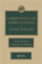 Book cover of Cardiovascular Complications of Liver Disease by Arieh Bomzon