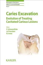 Book cover of Caries Excavation: Evolution of Treating Cavitated Carious Lesions by F. Schwendicke
