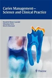 Book cover of Caries Management - Science and Clinical Practice by Hendrik Meyer-Lueckel