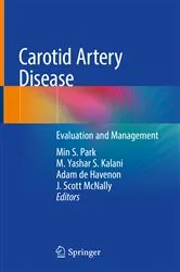 Book cover of Carotid Artery Disease by Min S. Park