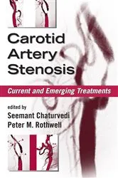 Book cover of Carotid Artery Stenosis by Seemant Chaturvedi