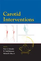 Book cover of Carotid Interventions by Peter Schneider