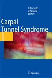 Book cover of Carpal Tunnel Syndrome by Riccardo Luchetti
