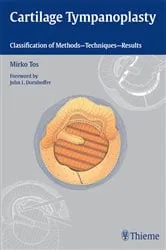 Book cover of Cartilage Tympanoplasty by Mirko Tos