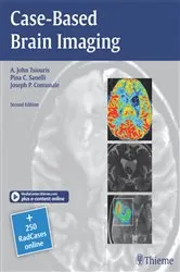 Book cover of Case-Based Brain Imaging (2nd ed.) by Unknown