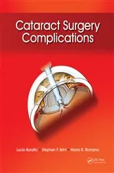 Book cover of Cataract Surgery Complications by Lucio Buratto