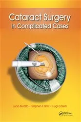 Book cover of Cataract Surgery in Complicated Cases by Lucio Buratto