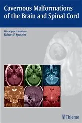 Book cover of Cavernous Malformations of the Brain and Spinal Cord by Giuseppe Lanzino
