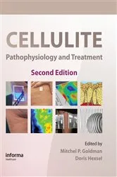 Book cover of Cellulite (2nd ed.) by Mitchel P. Goldman