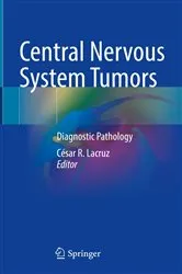 Book cover of Central Nervous System Tumors by César R. Lacruz