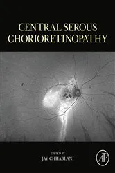Book cover of Central Serous Chorioretinopathy by Jay Chhablani MD