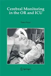 Book cover of Cerebral Monitoring in the OR and ICU by Unknown