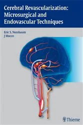 Book cover of Cerebral Revascularization: Microsurgical and Endovascular Techniques by Eric Nussbaum
