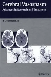 Book cover of Cerebral Vasospasm by R. Loch Macdonald