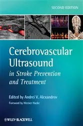 Book cover of Cerebrovascular Ultrasound in Stroke Prevention and Treatment (2nd ed.) by Andrei V. Alexandrov