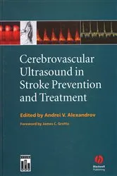Book cover of Cerebrovascular Ultrasound in Stroke Prevention and Treatment by Andrei V. Alexandrov