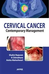 Book cover of Cervical Cancer by Shalini Rajaram