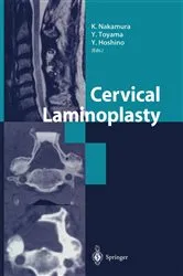 Book cover of Cervical Laminoplasty by K. Nakamura