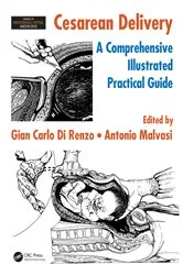 Book cover of Cesarean Delivery by Gian Carlo Di Renzo