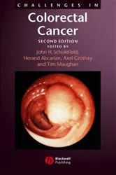 Book cover of Challenges in Colorectal Cancer (2nd ed.) by John H. Scholefield