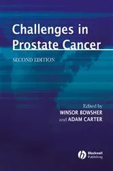 Book cover of Challenges in Prostate Cancer (2nd ed.) by Winsor Bowsher
