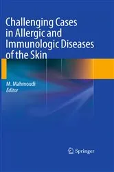 Book cover of Challenging Cases in Allergic and Immunologic Diseases of the Skin by Massoud Mahmoudi