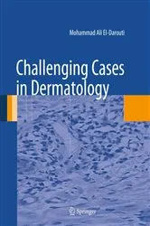 Book cover of Challenging Cases in Dermatology by Mohammad Ali El-Darouti