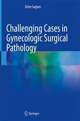Book cover of Challenging Cases in Gynecologic Surgical Pathology by Ozlen Saglam