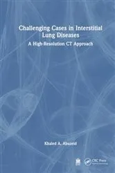 Book cover of Challenging Cases in Interstitial Lung Diseases by Khaled A. Abuzeid