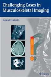 Book cover of Challenging Cases in Musculoskeletal Imaging by Jürgen Freyschmidt