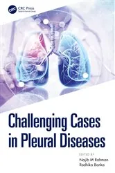 Book cover of Challenging Cases in Pleural Diseases by Unknown