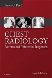 Book cover of Chest Radiology: Patterns and Differential Diagnoses E-Book (7th ed.) by James C. Reed MD