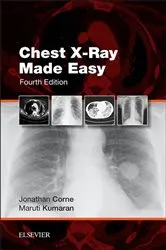 Book cover of Chest X-Ray Made Easy E-Book (4th ed.) by Corne MA, PhD, MB BS, FRCP, Jonathan