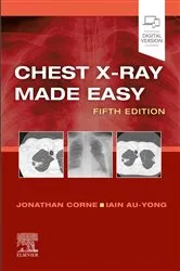 Book cover of Chest X-Ray Made Easy E-Book (5th ed.) by Corne MA, PhD, MB BS, FRCP, Jonathan
